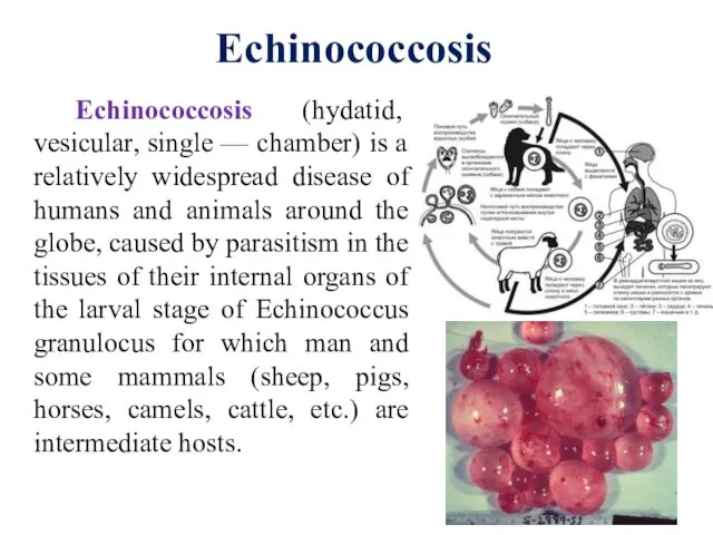 Echinococcosis (hydatid, vesicular, single — chamber) is a relatively widespread