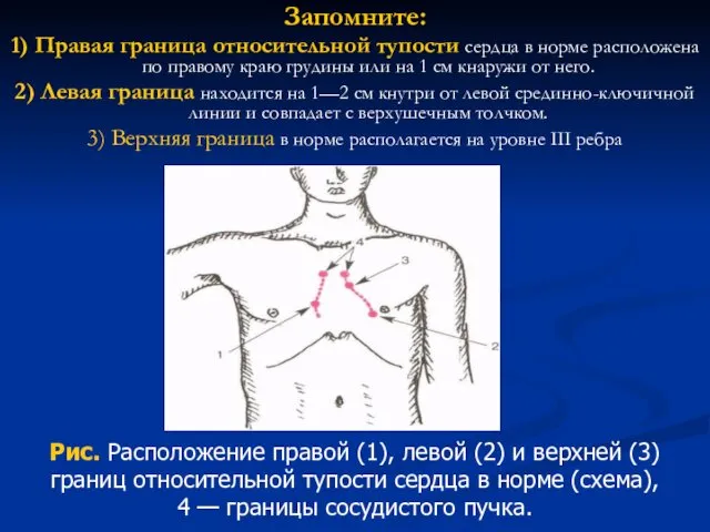 Запомните: 1) Правая граница относительной тупости сердца в норме расположена