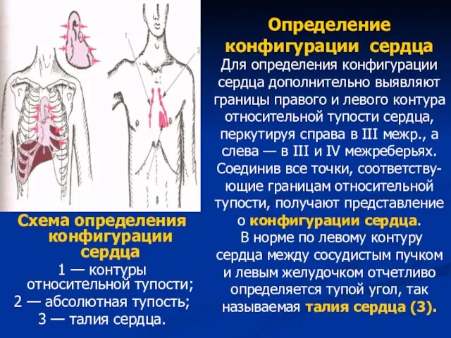 Схема определения конфигурации сердца 1 — контуры относительной тупости; 2