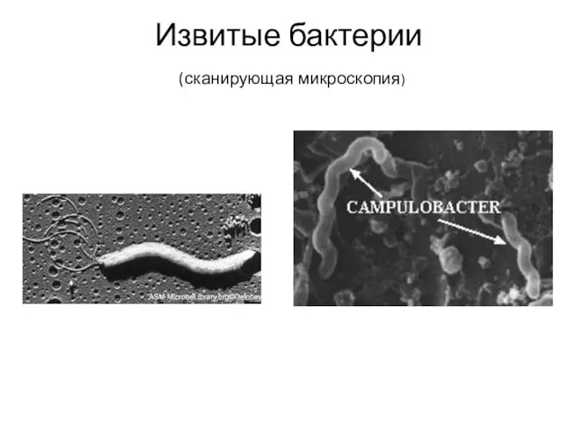 Извитые бактерии (сканирующая микроскопия)