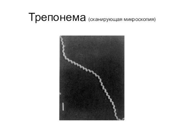 Трепонема (сканирующая микроскопия)