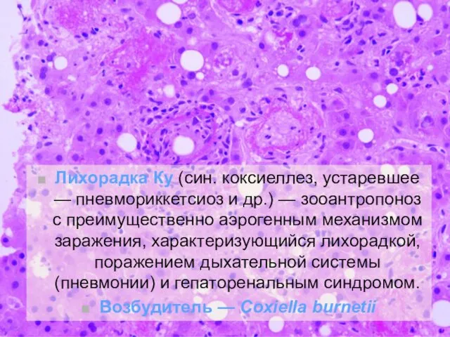Лихорадка Ку (син. коксиеллез, устаревшее — пневмориккетсиоз и др.) — зооантропоноз с преимущественно