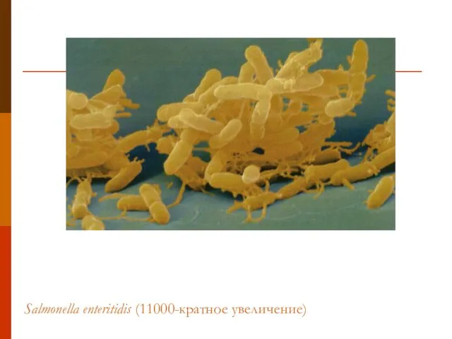 Salmonella enteritidis (11000-кратное увеличение)