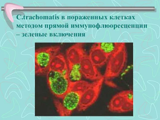 C.trachomatis в пораженных клетках методом прямой иммунофлюоресценции – зеленые включения