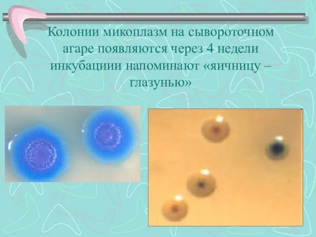 Колонии микоплазм на сывороточном агаре появляются через 4 недели инкубациии напоминают «яичницу – глазунью»