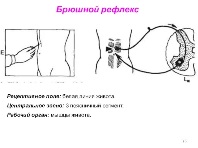 Брюшной рефлекс Рецептивное поле: белая линия живота. Центральное звено: 3 поясничный сегмент. Рабочий орган: мышцы живота.