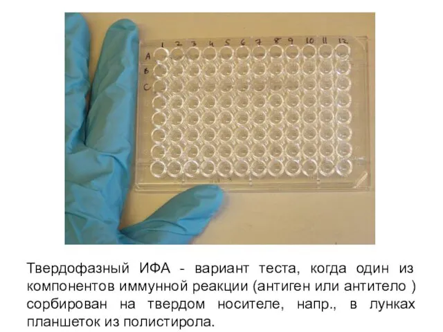 Твердофазный ИФА - вариант теста, когда один из компонентов иммунной