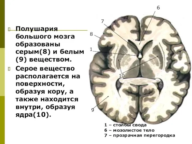 Полушария большого мозга образованы серым(8) и белым(9) веществом. Серое вещество