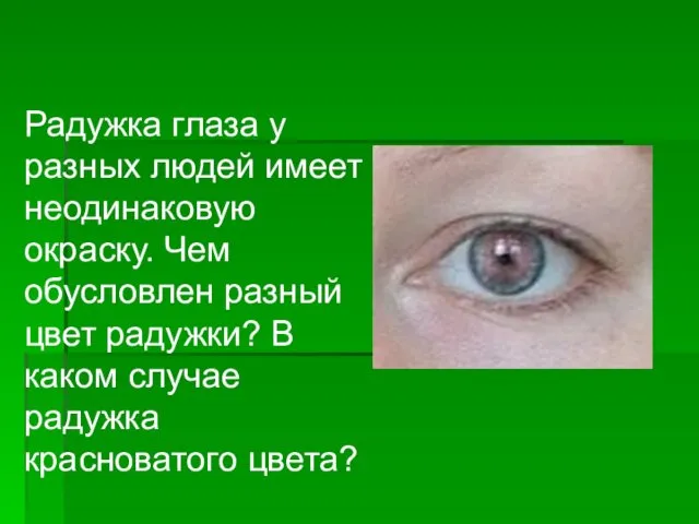 Радужка глаза у разных людей имеет неодинаковую окраску. Чем обусловлен разный цвет радужки?