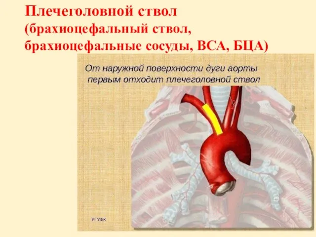 Плечеголовной ствол (брахиоцефальный ствол, брахиоцефальные сосуды, ВСА, БЦА)