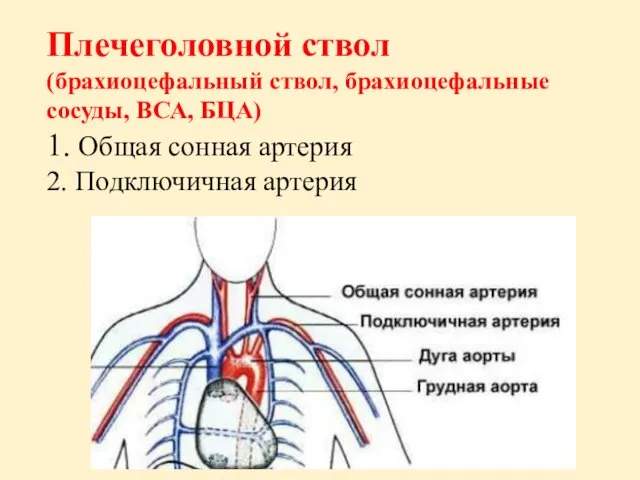 Плечеголовной ствол (брахиоцефальный ствол, брахиоцефальные сосуды, ВСА, БЦА) 1. Общая сонная артерия 2. Подключичная артерия