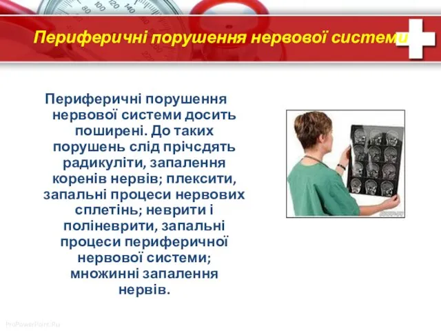 Периферичні порушення нервової системи Периферичні порушення нервової системи досить поширені.