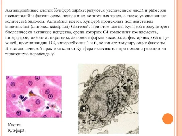 Активированные клетки Купфера характеризуются увеличением числа и размеров псевдоподий и