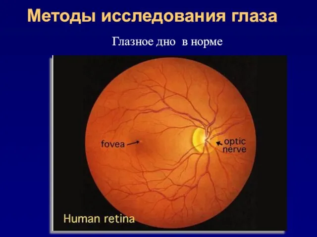 Методы исследования глаза Глазное дно в норме