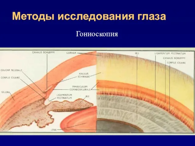 Методы исследования глаза Гониоскопия