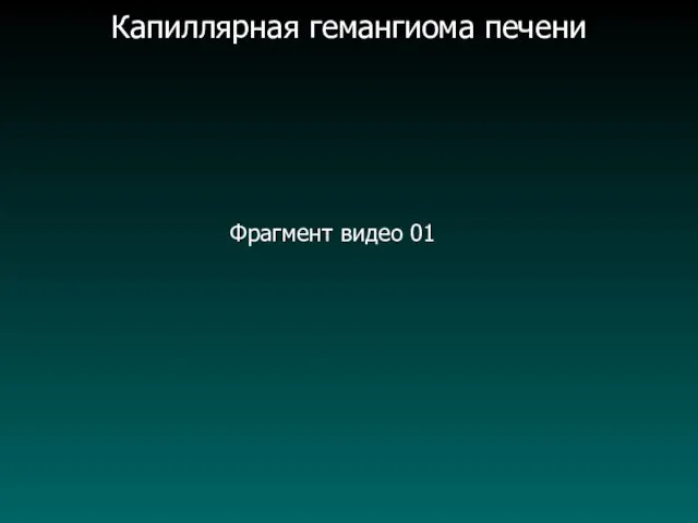 Капиллярная гемангиома печени Фрагмент видео 01