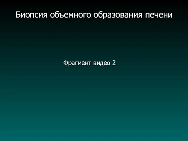 Фрагмент видео 2 Биопсия объемного образования печени