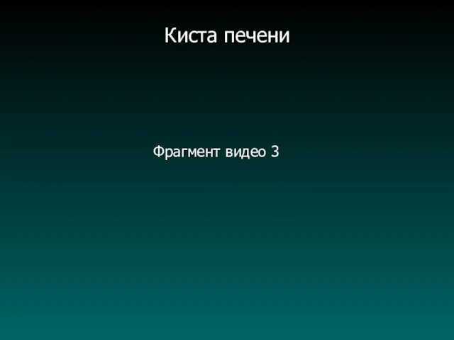 Фрагмент видео 3 Киста печени