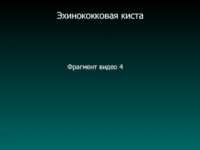 Фрагмент видео 4 Эхинококковая киста