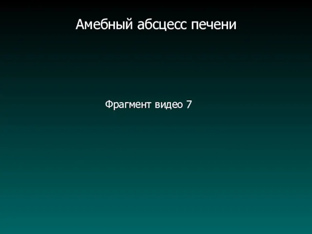 Фрагмент видео 7 Амебный абсцесс печени