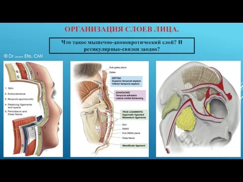 ОРГАНИЗАЦИЯ СЛОЕВ ЛИЦА. Что такое мышечно-апоневротический слой? И ретикулярные-связки заодно? © Dr Levent Efe, CMI