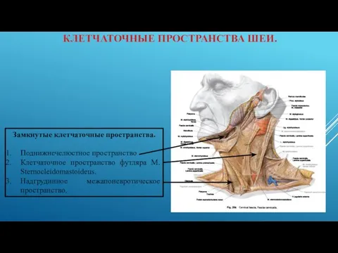 КЛЕТЧАТОЧНЫЕ ПРОСТРАНСТВА ШЕИ. Замкнутые клетчаточные пространства. Поднижнечелюстное пространство Клетчаточное пространство футляра M. Sternocleidomastoideus. Надгрудинное межапоневротическое пространство.