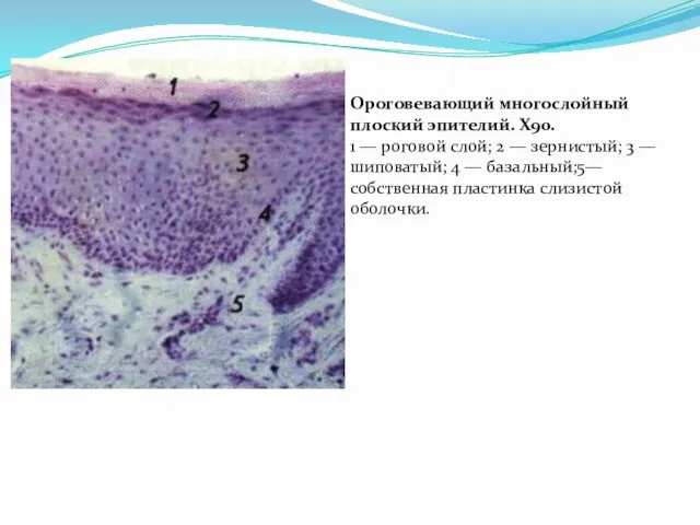 Ороговевающий многослойный плоский эпителий. Х90. 1 — роговой слой; 2 — зернистый; 3