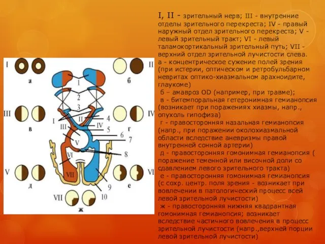 I, II - зрительный нерв; III - внутренние отделы зрительного