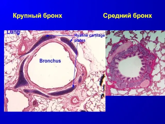 Крупный бронх Средний бронх