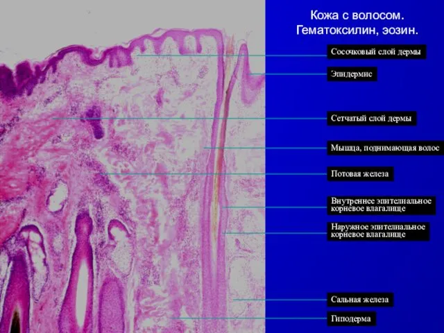 Кожа с волосом. Гематоксилин, эозин.