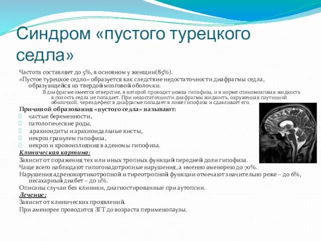 Синдром «пустого турецкого седла» Частота составляет до 5%, в основном