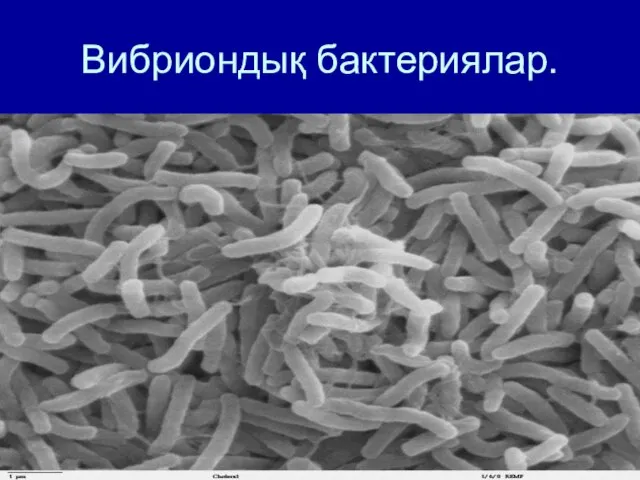 Вибриондық бактериялар.