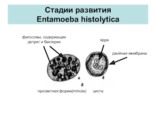 Стадии развития Entamoeba histolytica просветная форма(minuta) циста двойная мембрана ядра фагосомы, содержащие детрит и бактерии