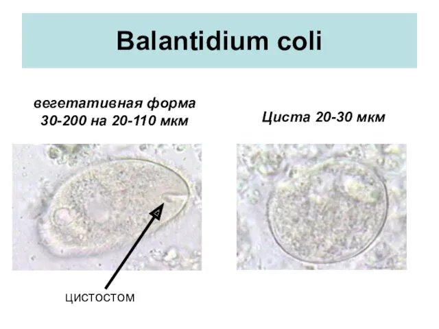 Balantidium coli цистостом вегетативная форма 30-200 на 20-110 мкм Циста 20-30 мкм