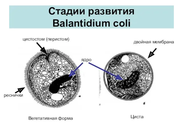 Стадии развития Balantidium coli Вегетативная форма Циста цистостом (перистом) ядро реснички двойная мембрана
