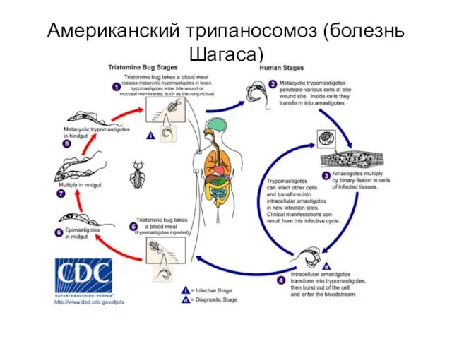 Американский трипаносомоз (болезнь Шагаса)