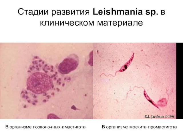 Стадии развития Leishmania sp. в клиническом материале В организме москита-промастигота В организме позвоночных-амастигота
