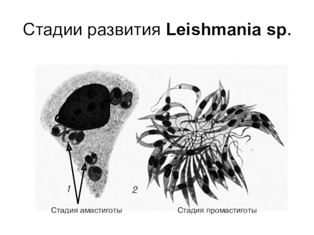 Стадии развития Leishmania sp. Стадия амастиготы Стадия промастиготы