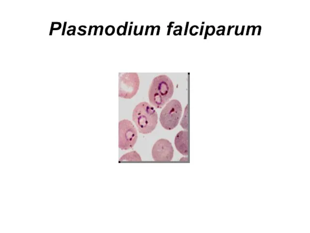 Plasmodium falciparum