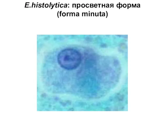 E.histolytica: просветная форма (forma minuta)