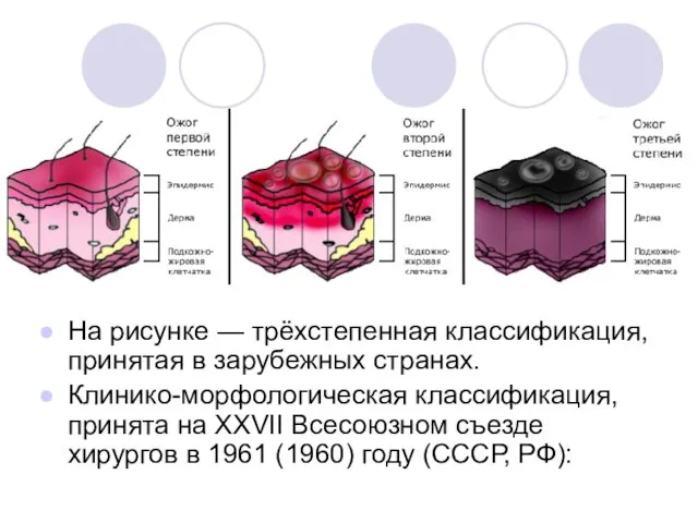 На рисунке — трёхстепенная классификация, принятая в зарубежных странах. Клинико-морфологическая