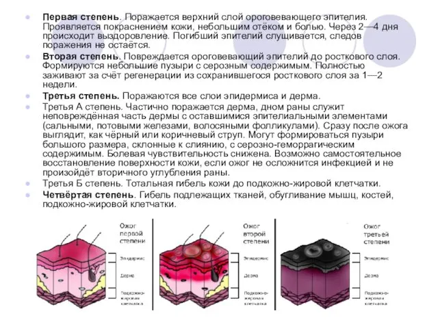 Первая степень. Поражается верхний слой ороговевающего эпителия. Проявляется покраснением кожи, небольшим отёком и