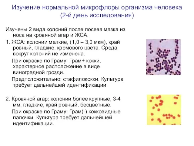Изучение нормальной микрофлоры организма человека (2-й день исследования) Изучены 2 вида колоний после