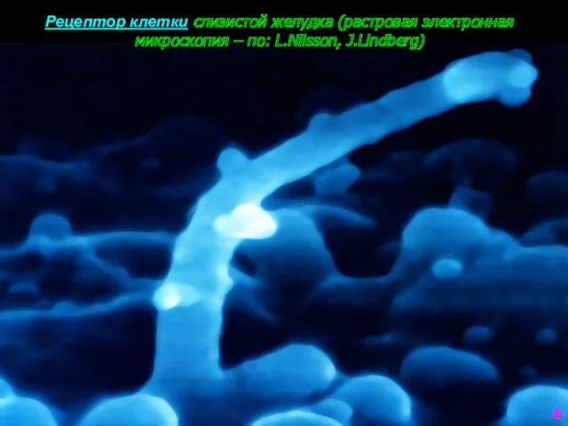Рецептор клетки слизистой желудка (растровая электронная микроскопия – по: L.Nilsson, J.Lindberg) 6