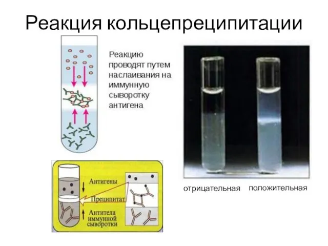 Реакция кольцепреципитации отрицательная положительная