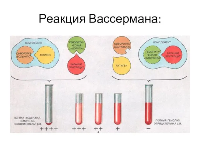 Реакция Вассермана: