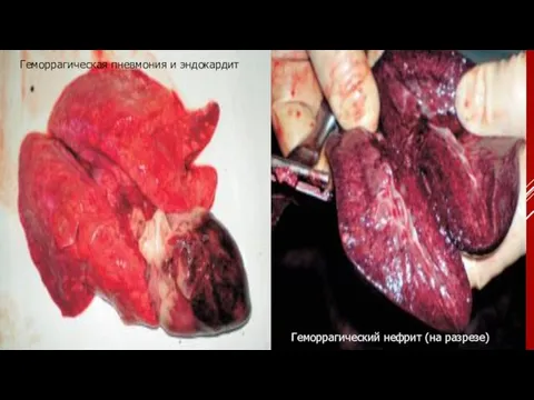 Геморрагическая пневмония и эндокардит Геморрагический нефрит (на разрезе)