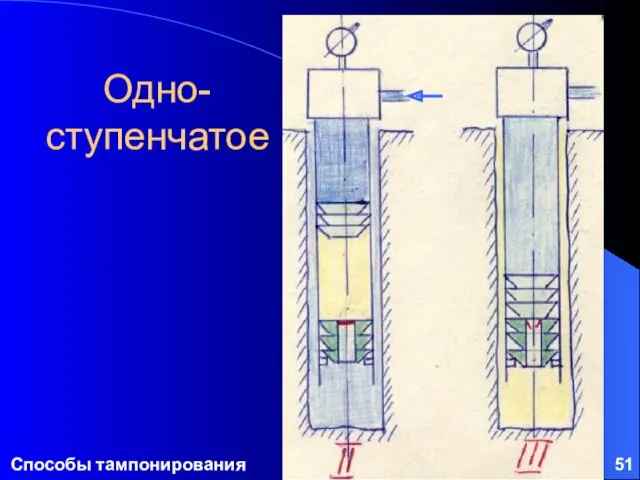 Способы тампонирования Одно-ступенчатое