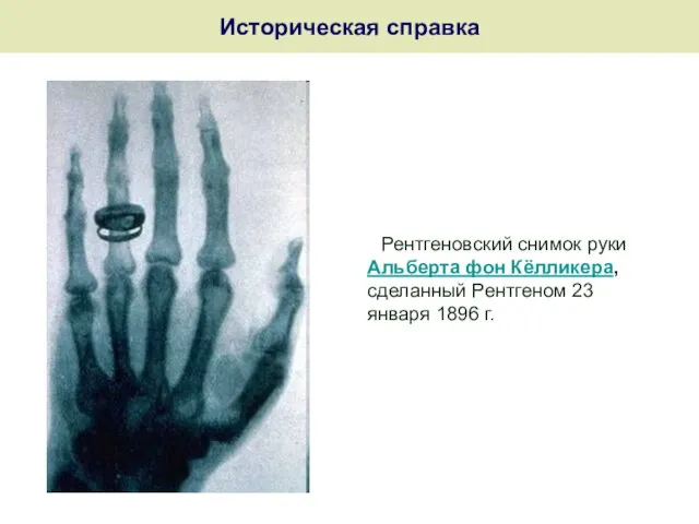 Историческая справка Рентгеновский снимок руки Альберта фон Кёлликера, сделанный Рентгеном 23 января 1896 г.