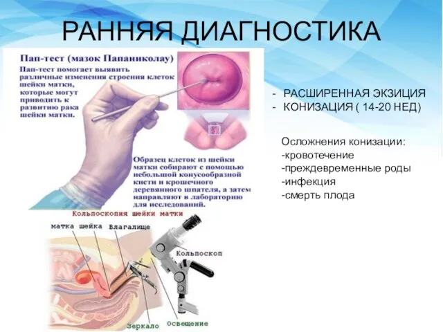 РАННЯЯ ДИАГНОСТИКА РАСШИРЕННАЯ ЭКЗИЦИЯ КОНИЗАЦИЯ ( 14-20 НЕД) Осложнения конизации: -кровотечение -преждевременные роды -инфекция -смерть плода